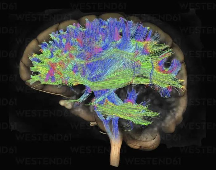 Трактографія (DTI) мозку
